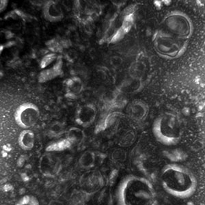 Dark Matter